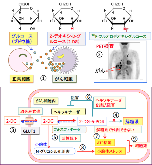 2-デオキシグルコースの抗がん作用